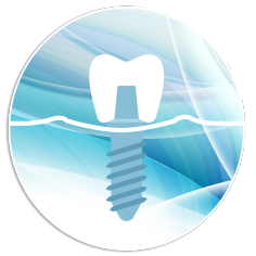 dental-implants_nesher